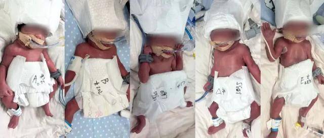 新疆一24岁产妇凌晨生下5胞胎（1男4女），最重1030克，最轻仅870克，概率六千万分之一:二手矿山机械厂家